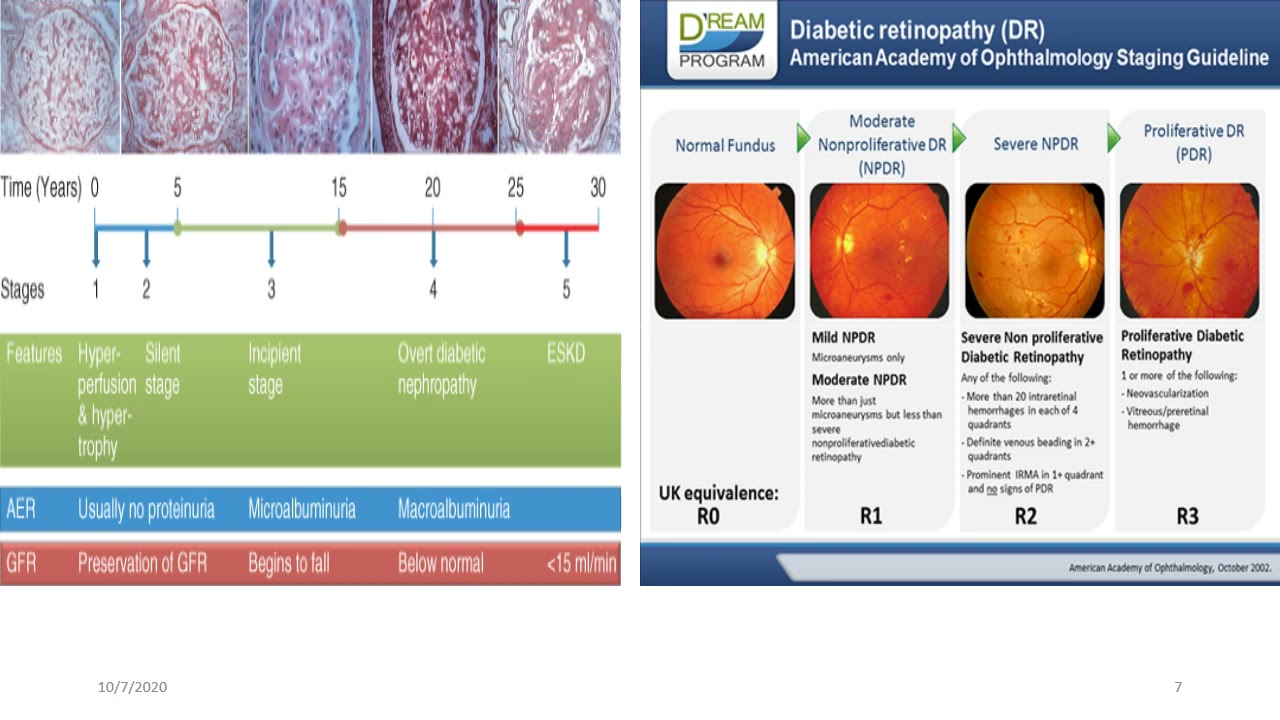 المحاضرة الرابعة فى مادة (باطنة عامة) بعنوان Diabetes للفرقة الأولى بالمعهد