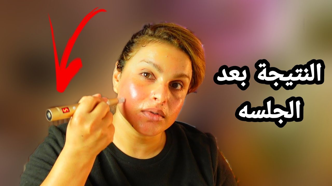 سر صفاء البشره الجلسه الثانية من الديرمابن + سيروم والفيتامينات؟!