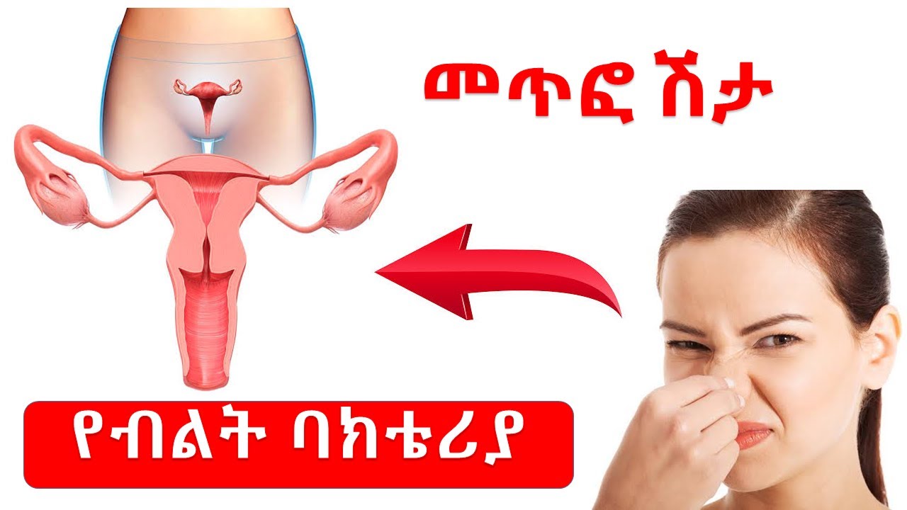 በብልት ላይ የሚከሰት ባክቴሪያ መንስኤ/ ምልክቶች/መፍትሔ// Bacterial vaginosis
