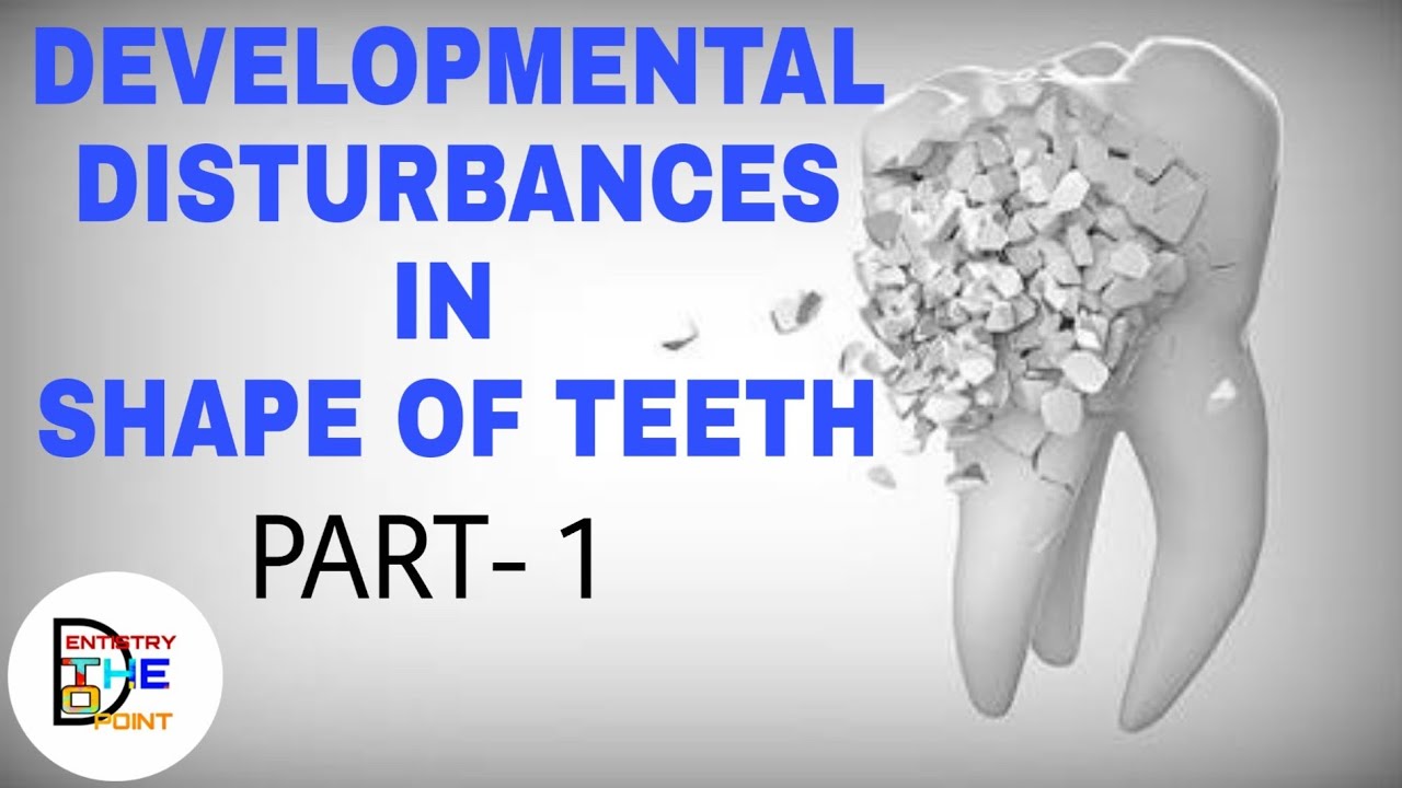 DEVELOPMENTAL DISTURBANCES IN SHAPE OF TEETH - PART 1
