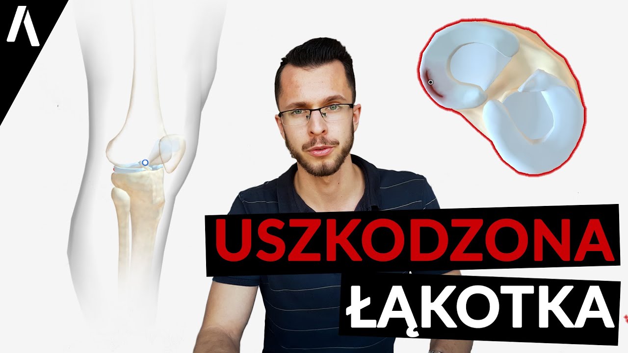 Uszkodzona Łąkotka *Pęknięta* | Co warto o niej wiedzieć?