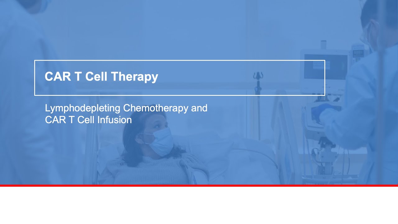 CAR T cell therapy: Lymphodepleting chemotherapy and cell infusion