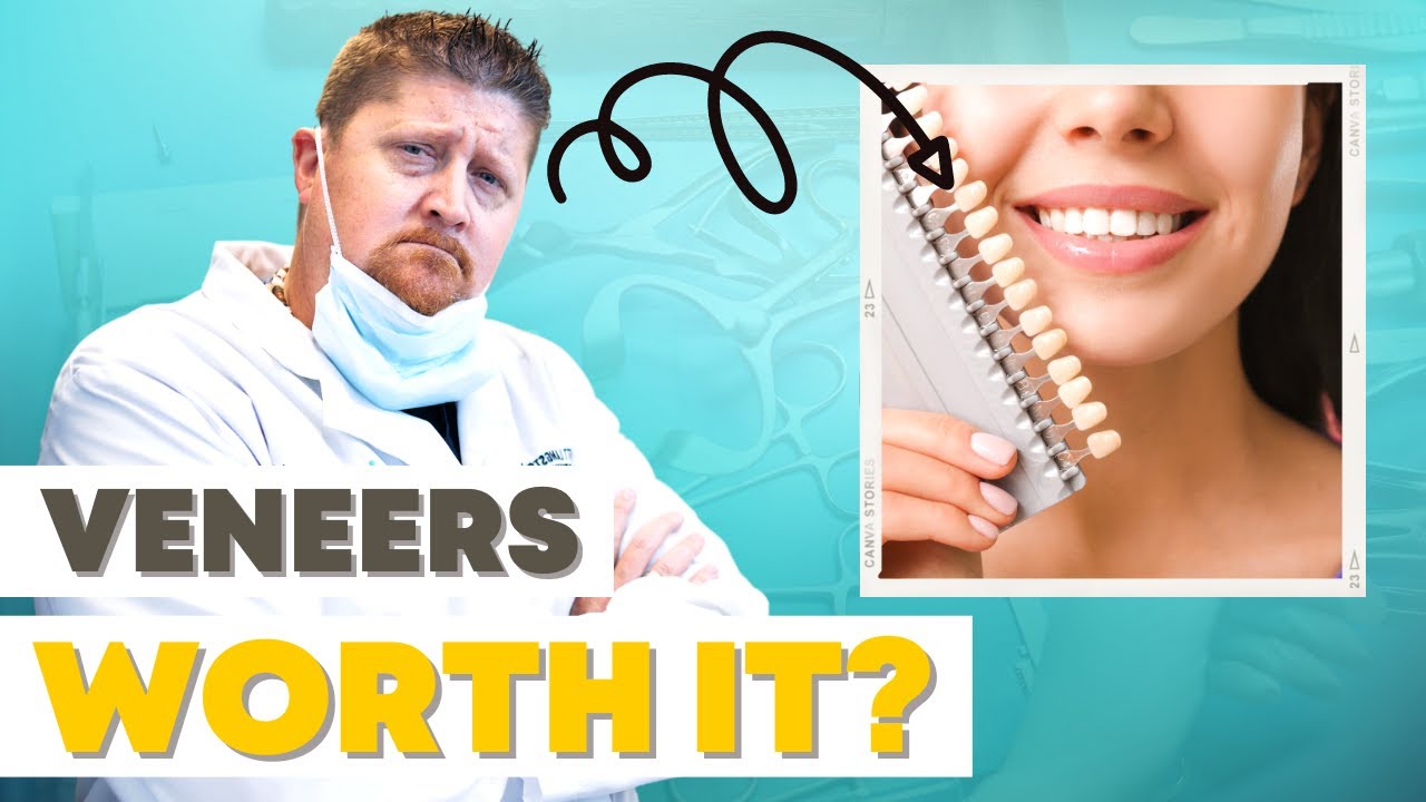The Pros & Cons of Dental Veneers - Are They Worth It?