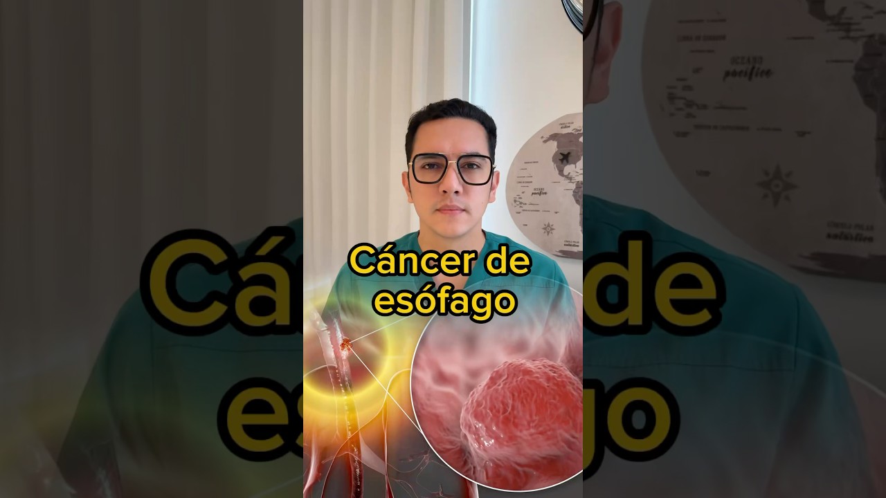S&iacute;ntomas del c&aacute;ncer de es&oacute;fago que se pueden confundir con infecciones comunes. #medicina #shorts