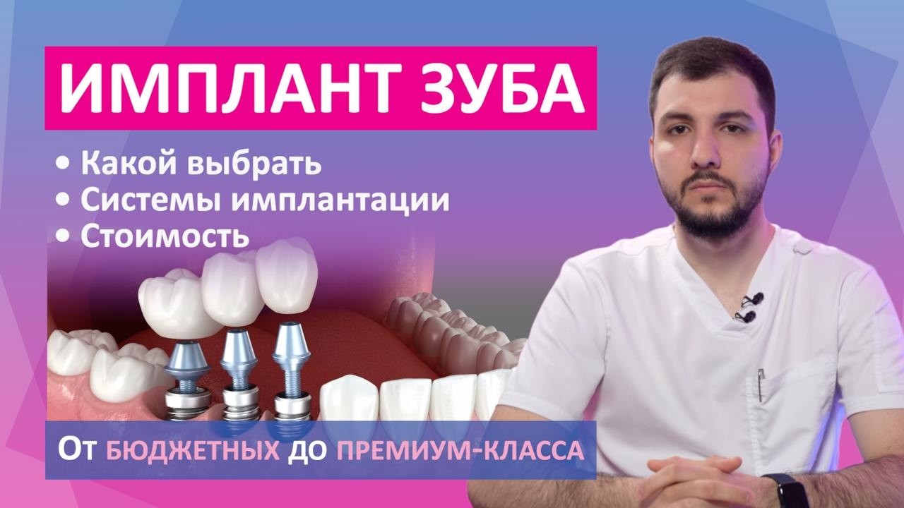 Зубные импланты: бюджетные, средние и премиум-системы. Какой выбрать и от чего зависит цена.