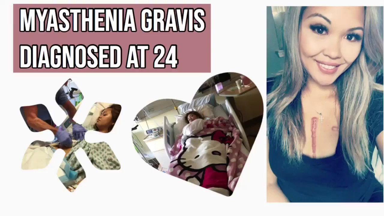 MYASTHENIA GRAVIS| DIAGNOSED AT 24|MY STORY