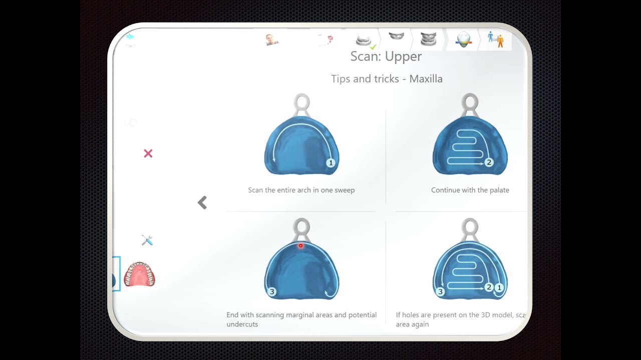 Digital Dentures:  How to use the three visit method.