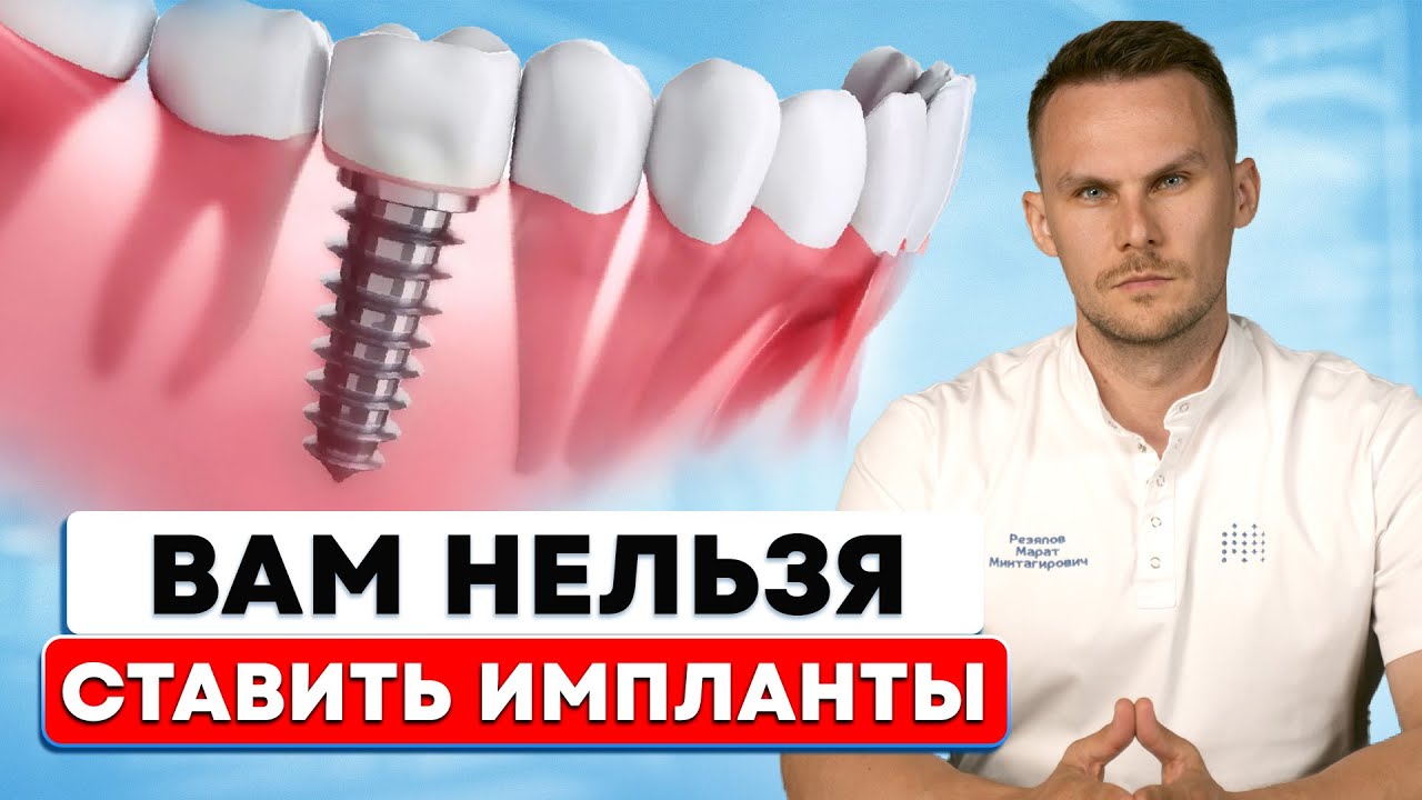 Вам ЗАПРЕЩЕНО СТАВИТЬ ИМПЛАНТЫ! – Стоматологи ЭТО НЕ ДОГОВАРИВАЮТ