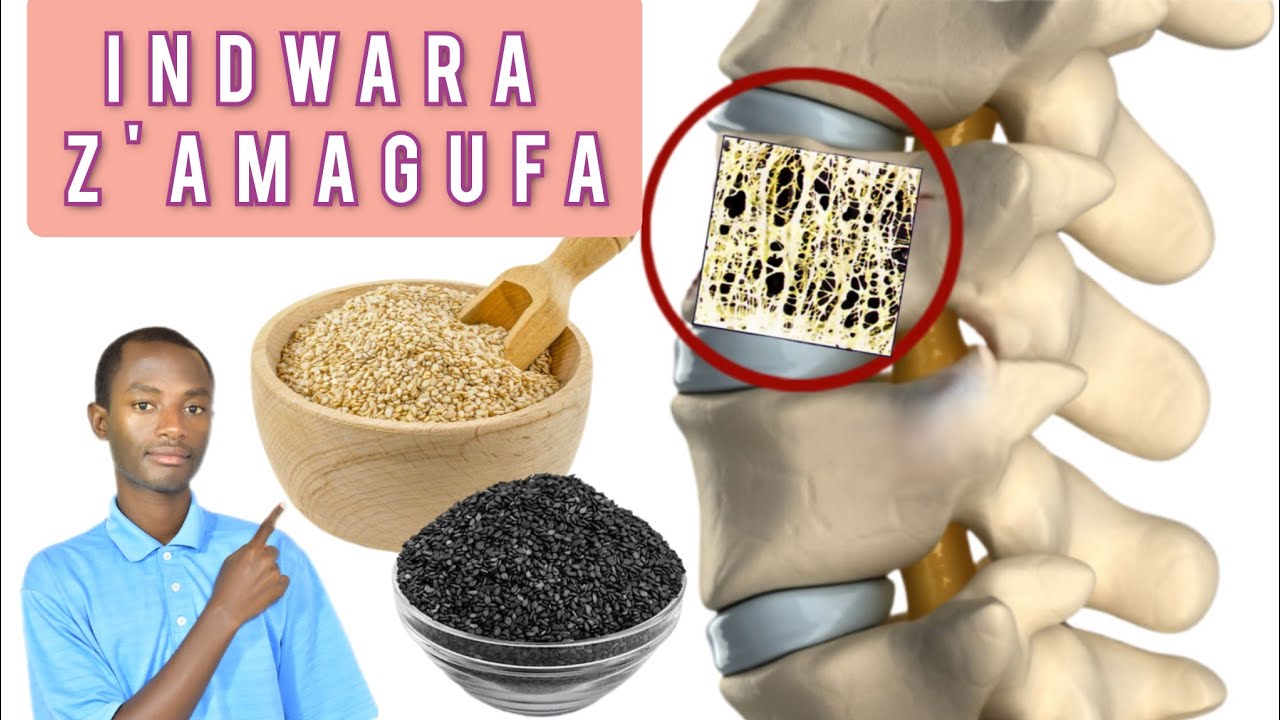INDWARA Z'AMAGUFA n'uburyo zavurwa. Umugongo, kumungwa, amavi, ingingo(joints)