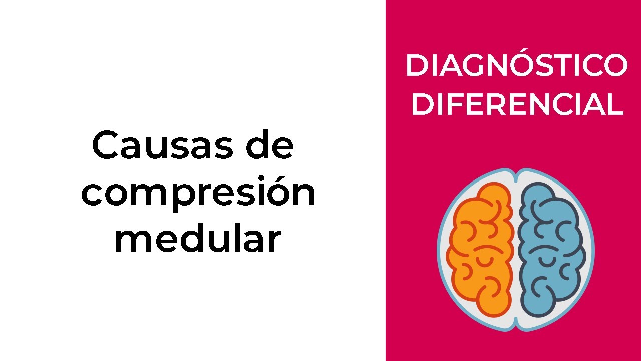 Diagn&oacute;stico Diferencial. Causas de compresi&oacute;n medular