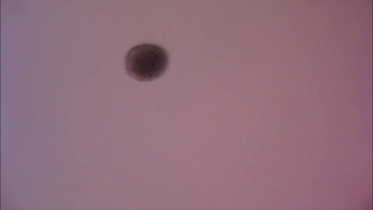 box jelly planula larva