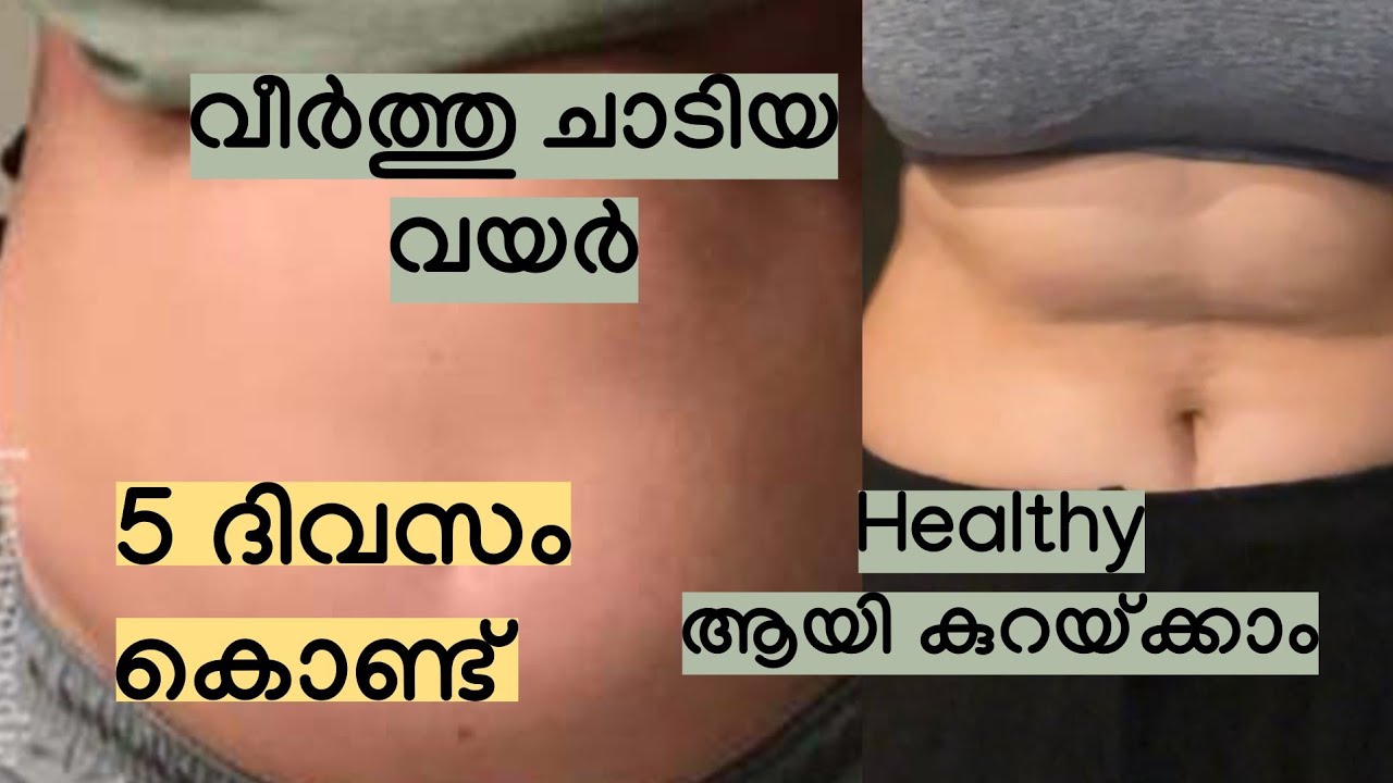 വീർത്തു ചാടിയ വയർ  5 ദിവസം കൊണ്ട് കുറയ്ക്കാം // Weight reduction - Malayalam 