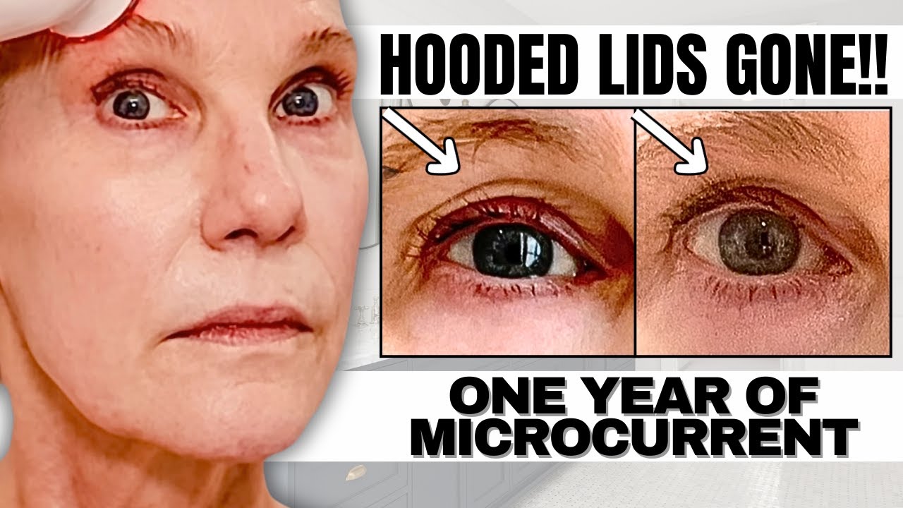 One YEAR OF MICROCURRENT On My Mature, Over 50 Skin (Surprising, Unexpected Results!)