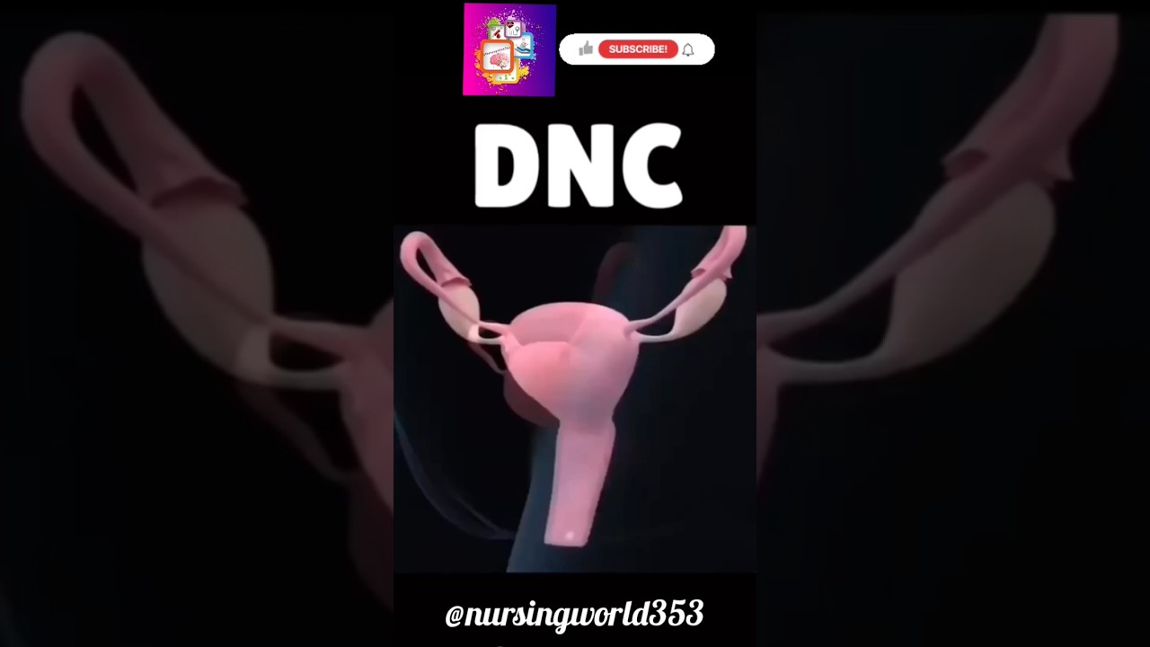 DNC|d&c|dilatation and Curratage| dilatation and Curratage procedure|D and C|dnc