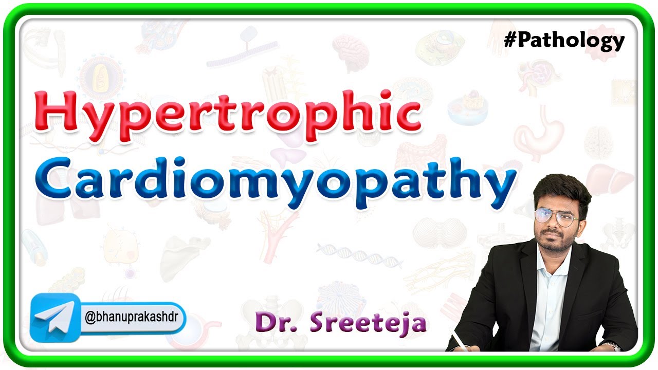 9: Hypertrophic Cardiomyopathy: Pathology USMLE Step 1