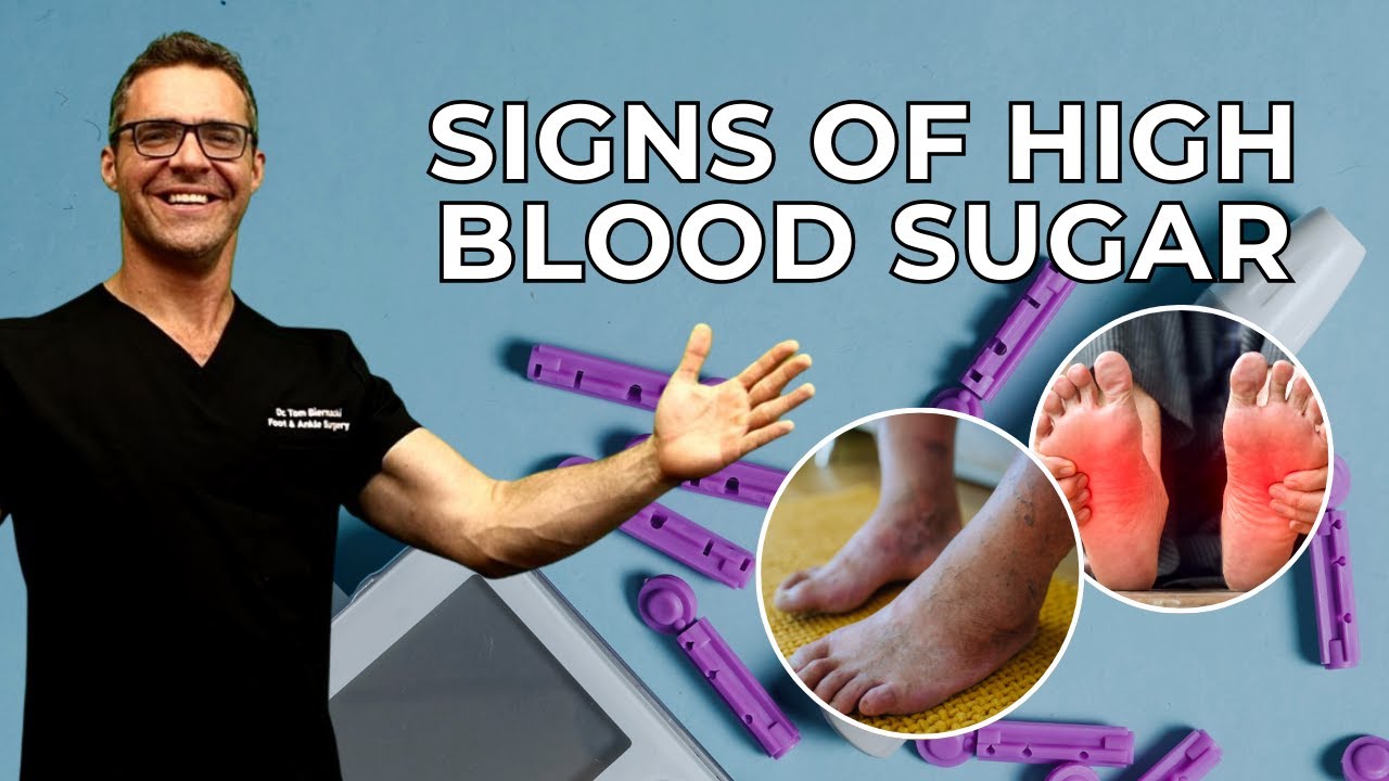 Top 10 Signs of High Blood Sugar & Diabetes!