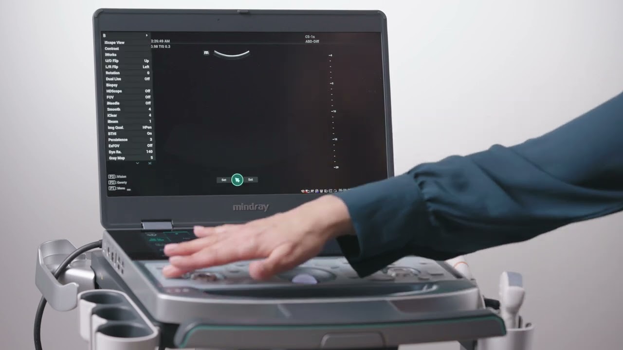04  ZST+ Mindray MX7 Ultrasound