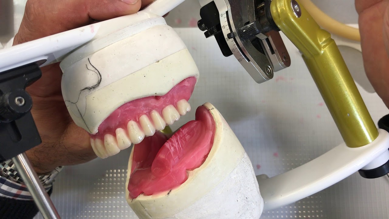 Complete Maxillary and Mandibular Tooth Arrangement #5