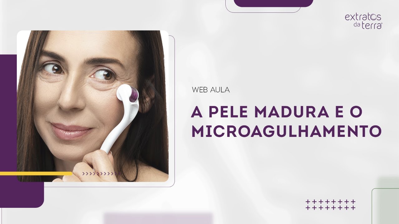 Microagulhamento na Pele Madura: Guia Completo para Esteticistas | Web Aula gratuita #160
