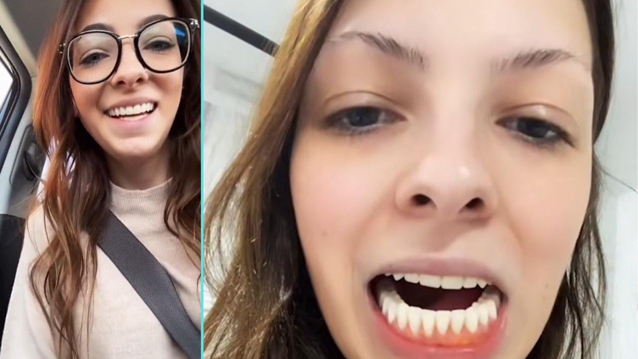 I Lost My Teeth In My 20s - The Positivity Fix