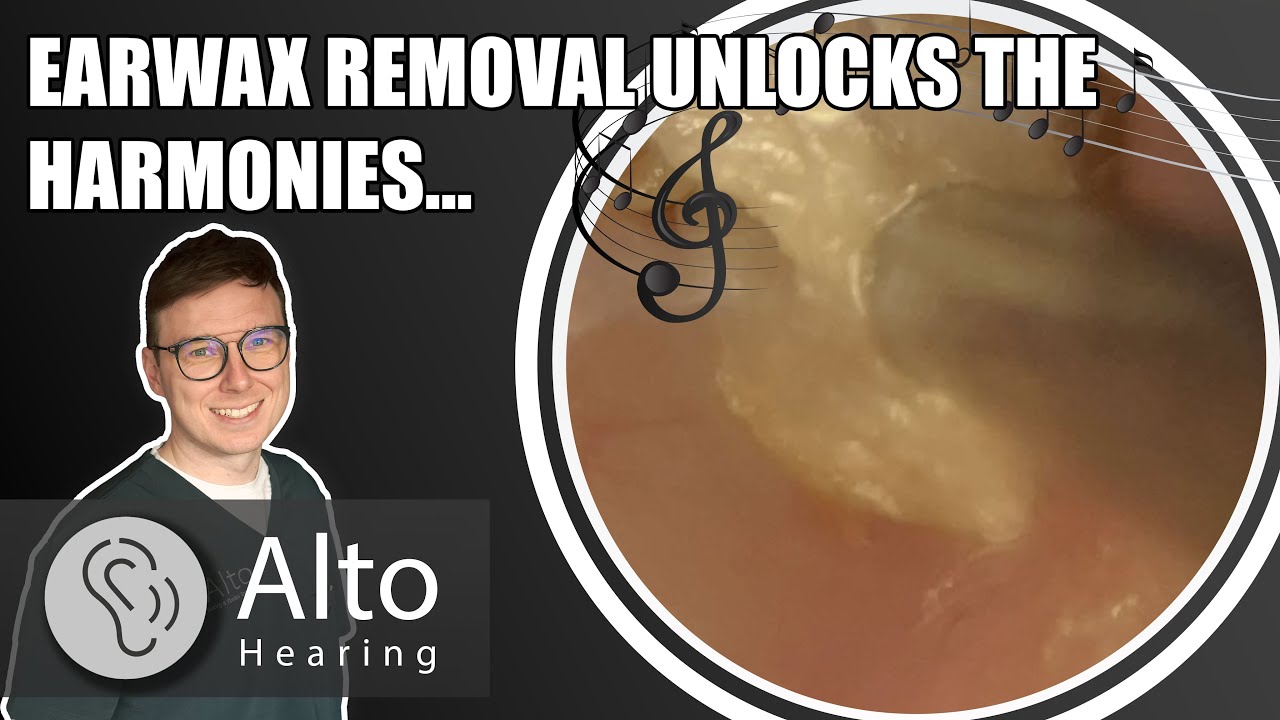From Muffled to Melodic: Earwax Removal Restores Singers Hearing #014