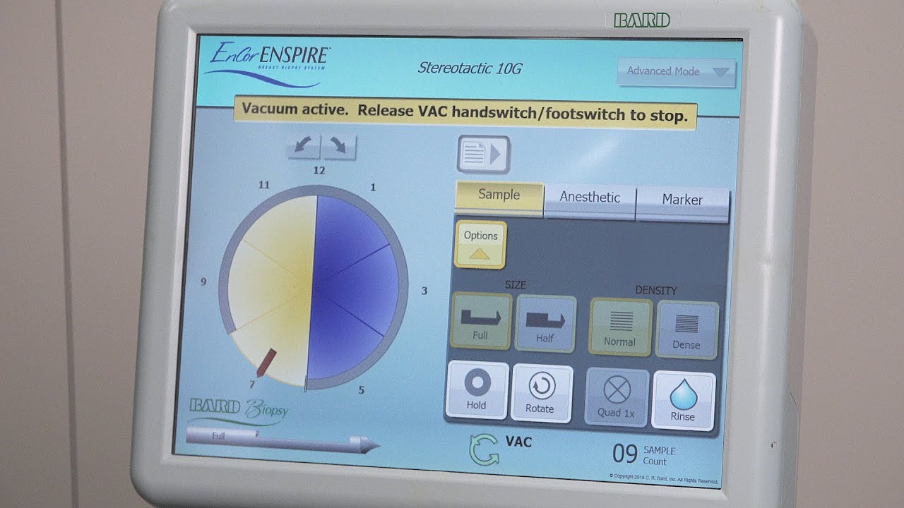 Encor Enspire Breast Biopsy System - BD Europe