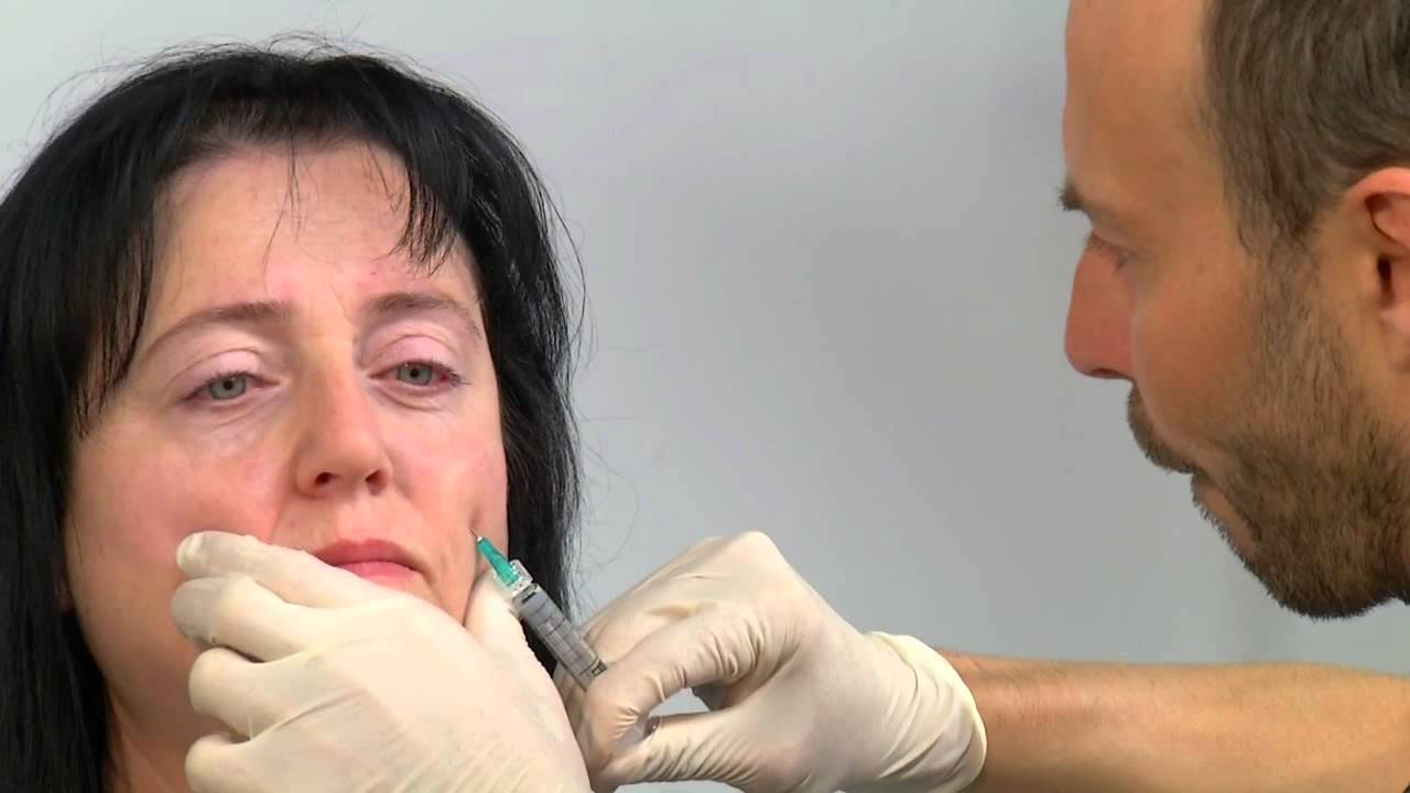 La prévention des rides 4