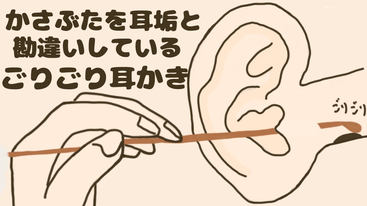 【ASMR】かさぶたを耳垢と勘違いしてるごりごり耳かき Ear Cleaning【No Talking】