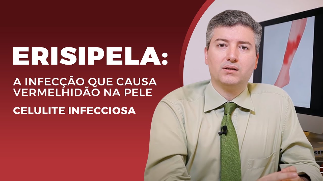 Erisipela: A infec&ccedil;&atilde;o que causa vermelhid&atilde;o na pele. Celulite infecciosa.