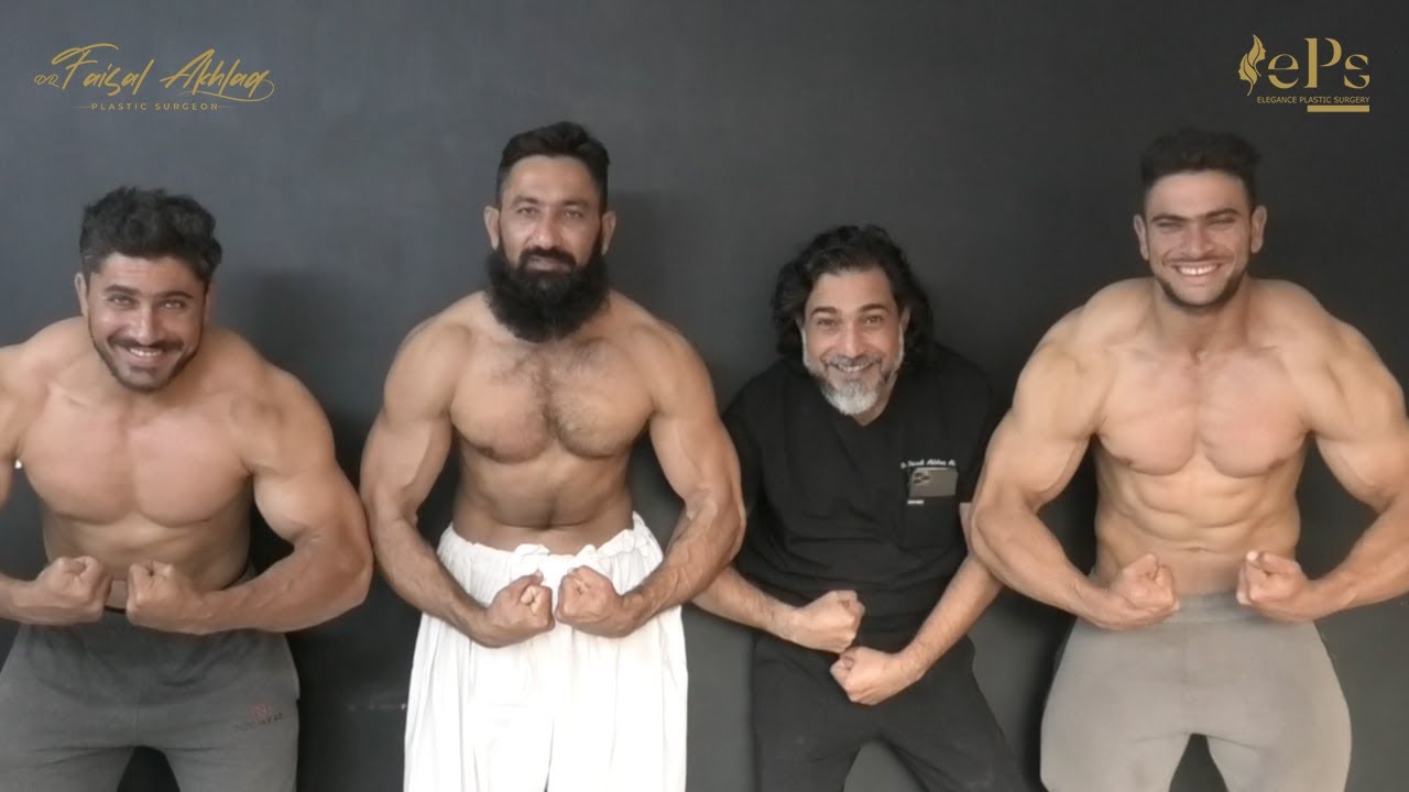 Gynecomastia Surgery!!! Happy Bodybuilders