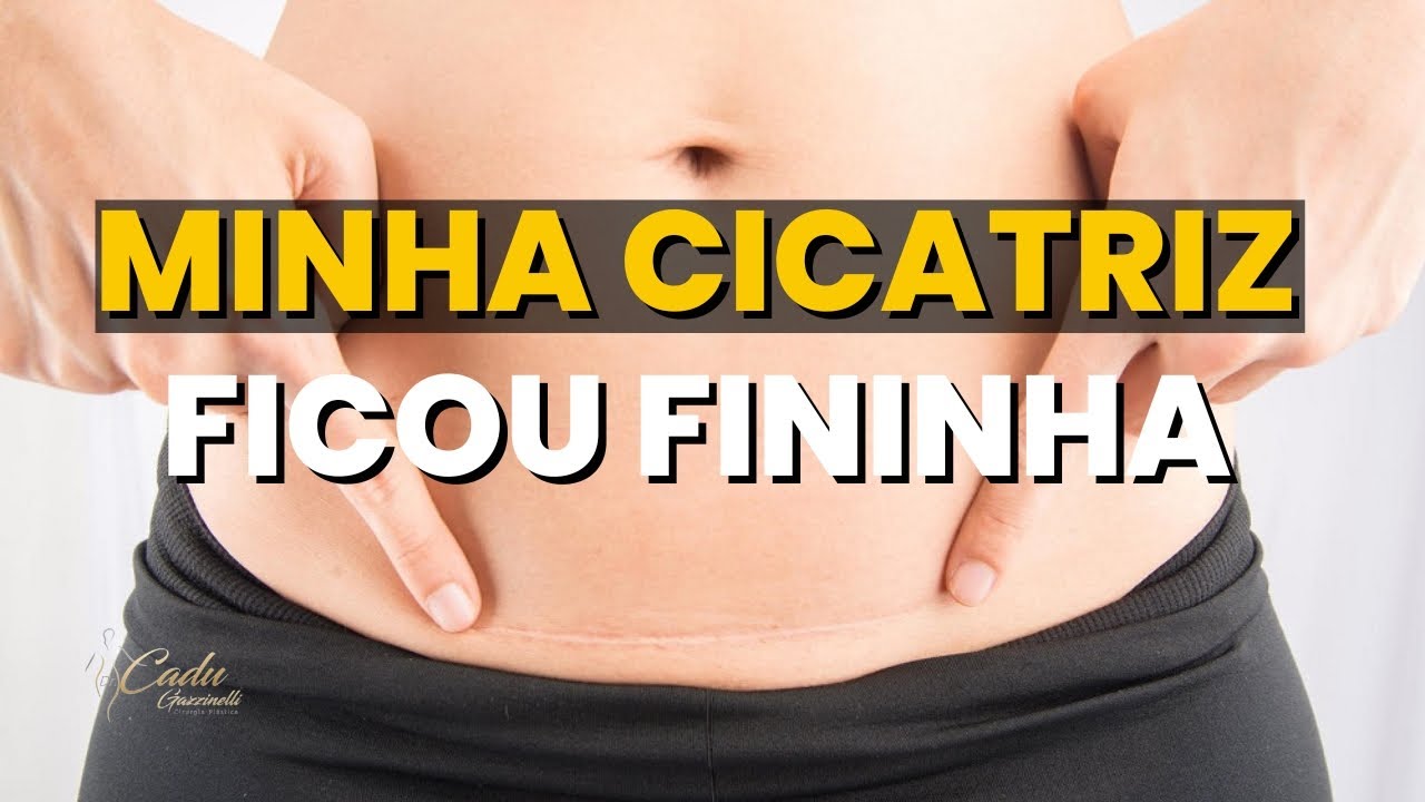 APRENDA O QUE FAZER para ter uma CICATRIZ BOA