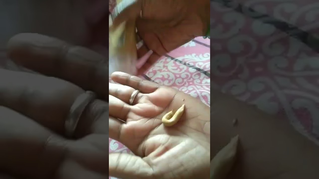 pimples .free .😍Modicare products.....😍