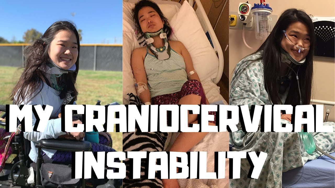 MY CRANIOCERVICAL INSTABILITY SYMPTOMS