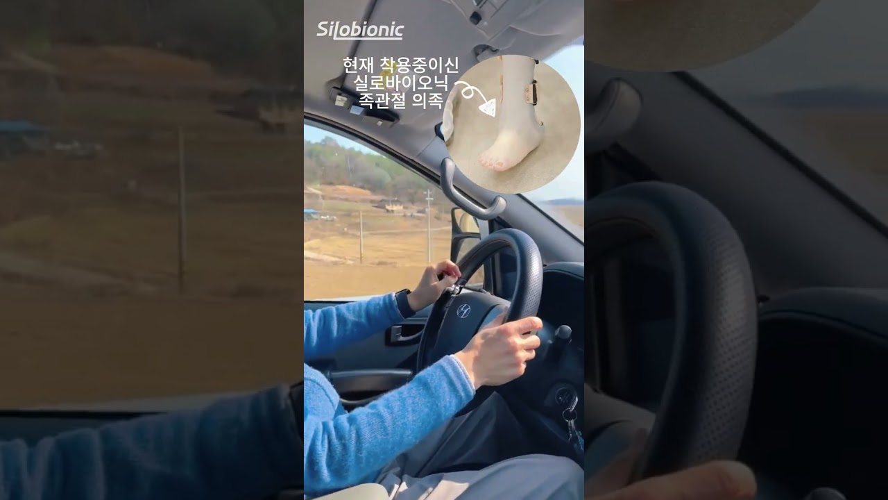 족관절 의족 착용 후 직접 운전! 리얼 후기 대공개 🚗