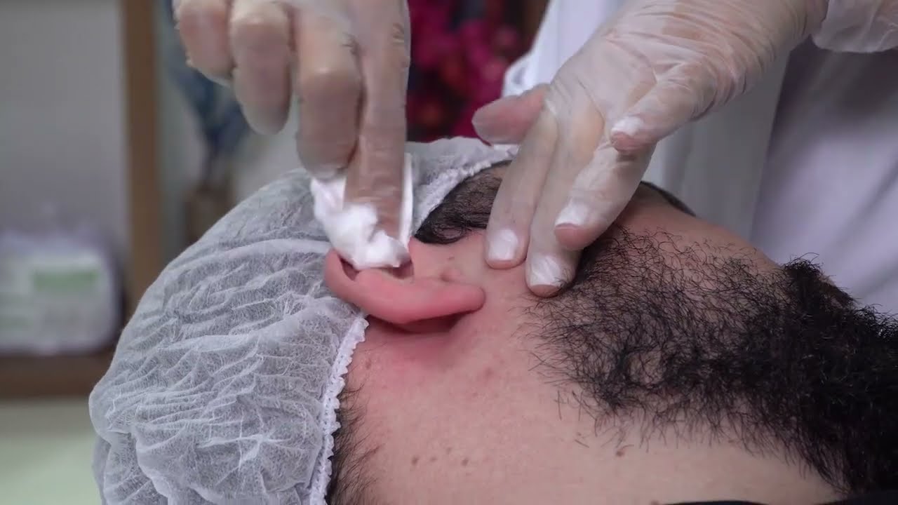 Como Depilar Orelha Masculina com Luciana Carvalho | Depil Bella
