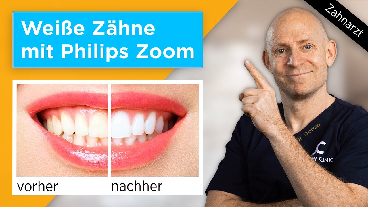 So schädlich ist Zahnbleaching | Das ist die Wahrheit