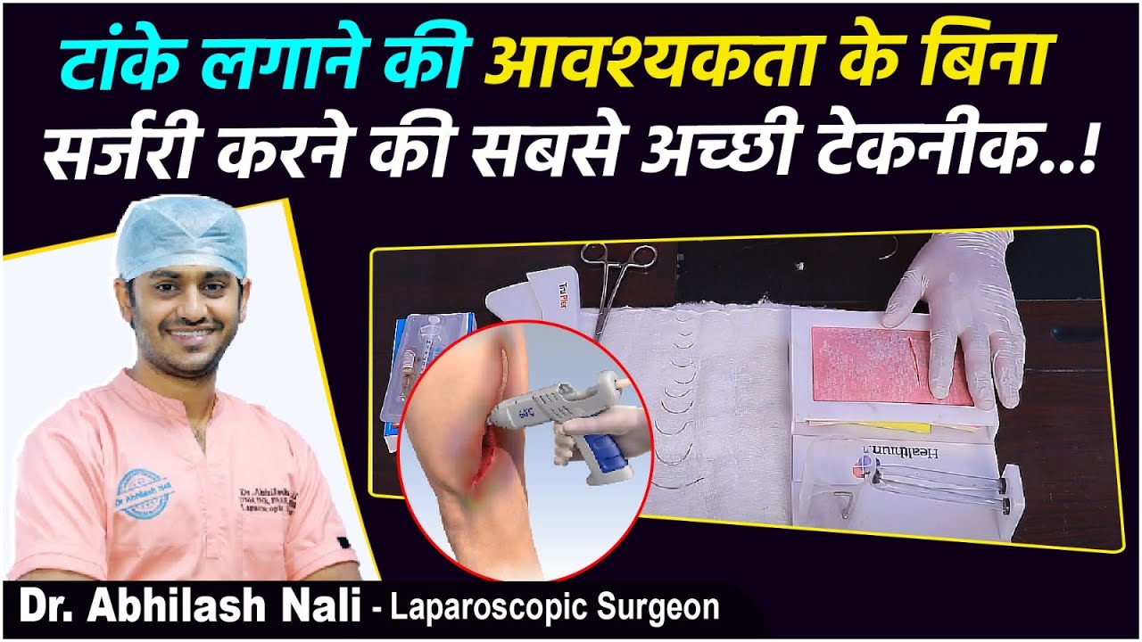 Types of Wound Closure After Surgery in Hindi | Painless Alternative to Stitches | Dr Abhilash Nali