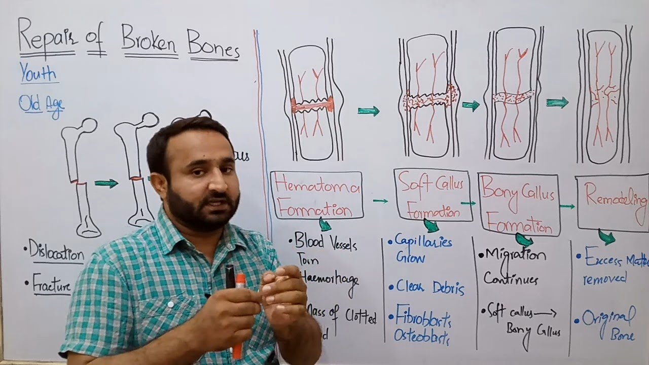 Ch 16 Lec 13 Repair of Broken Bones, Class 12 Biology