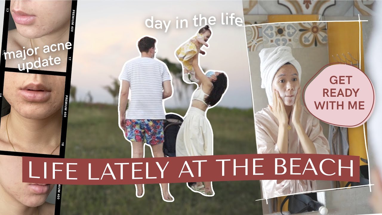 Beach Life Update + Major Breakout 😭 | Camille Co