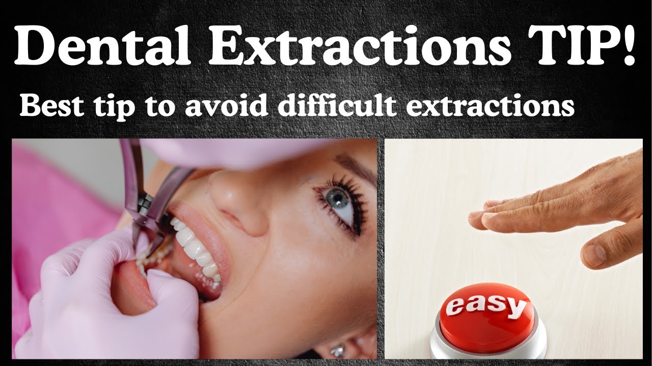 The Gentle Extraction Technique That Makes Difficult Teeth Come Out Effortlessly