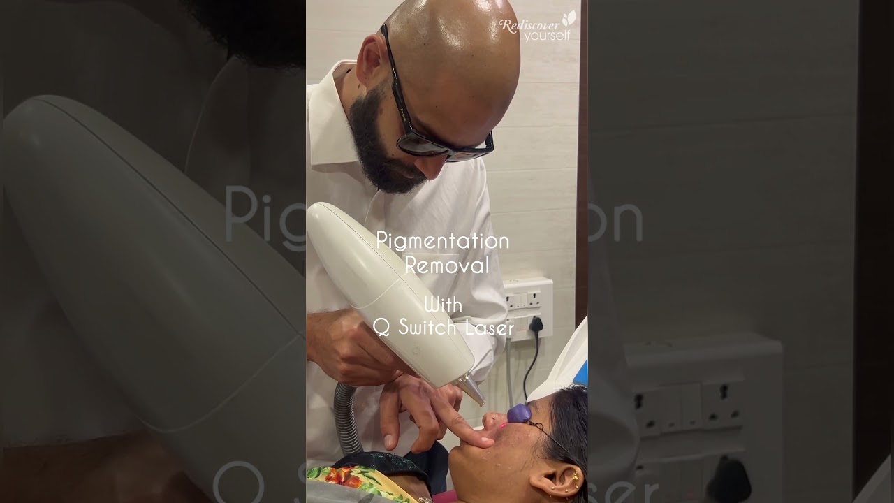Q-Switch Laser Skin Treatments &ndash; The Ultimate Solution for Pigmentation Removal | Pune | 9834655013