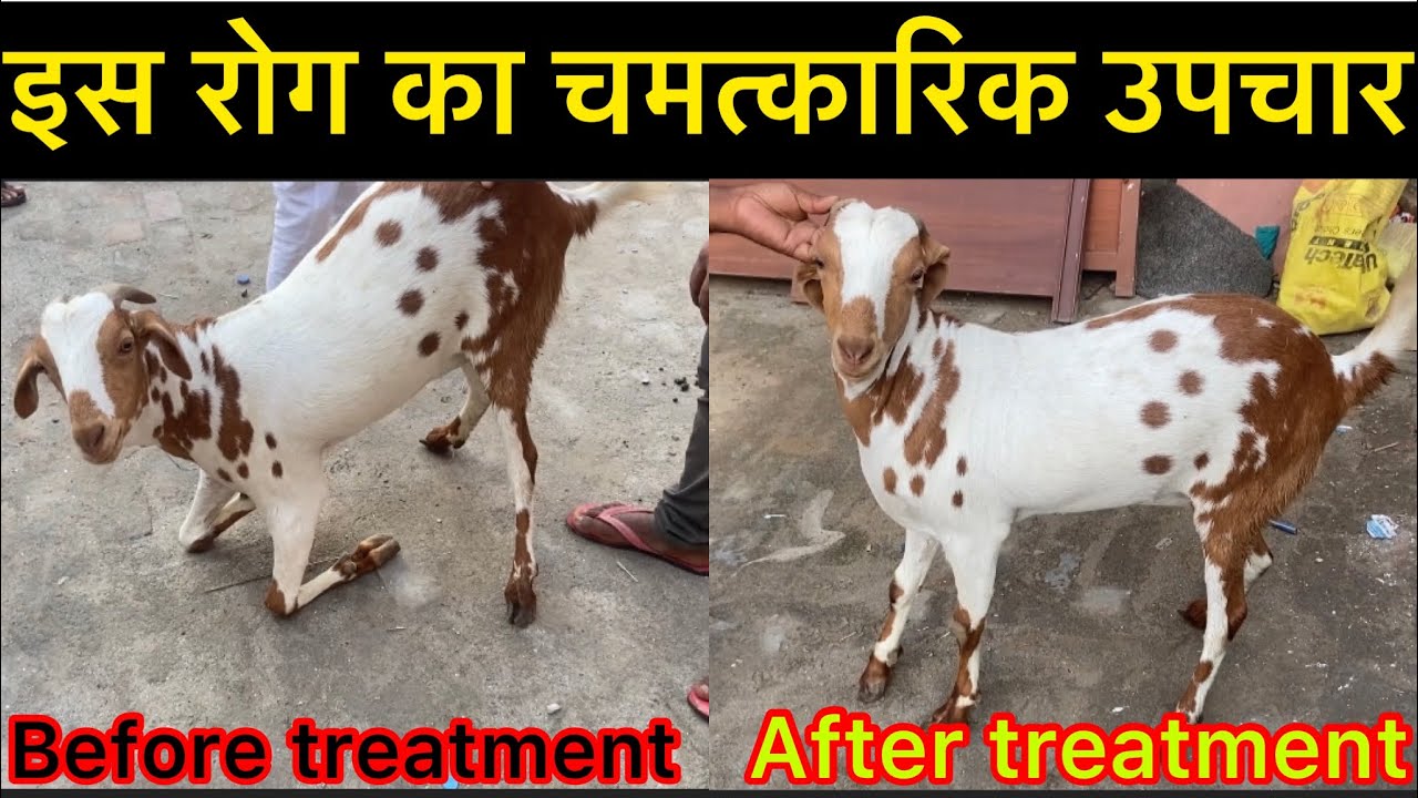 Knuckling l घुटने के बल चलना I treatment of knuckling l dr umar khan