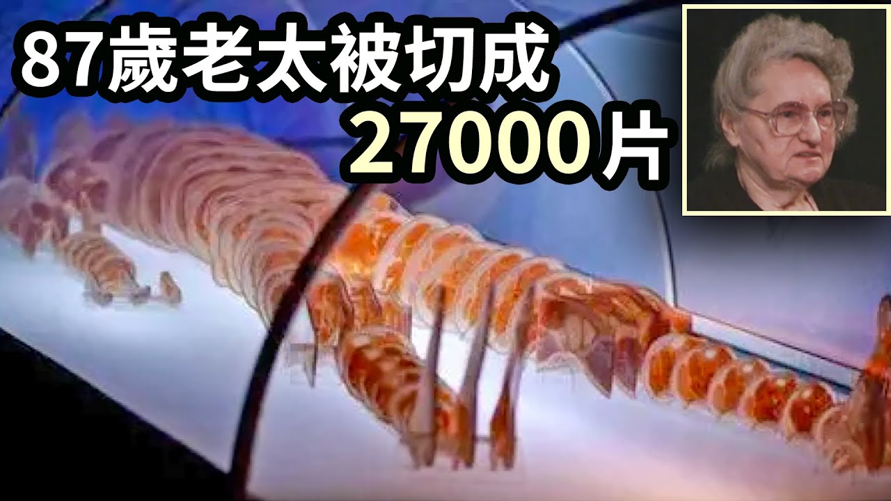 87歲老太死後被切成27000片，被萬人圍觀！每一片肉體都經過打磨拋光，成為史上最慘人類遺體 | 數字人 | 可視人 | 解剖