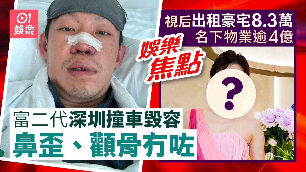 富二代深圳撞車毀容鼻歪顴骨冇咗需矯形｜視后出租豪宅8.3萬創新高名下物業逾4億｜10月4日娛樂新聞 #今日娛樂 #香港01