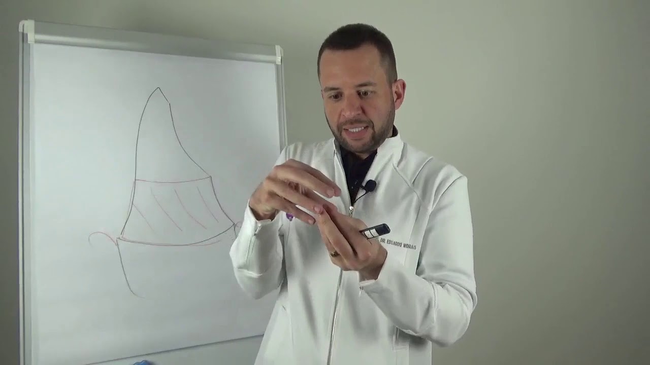 Aula 1 - Princípios de preparo para coroas totais (parte 1)
