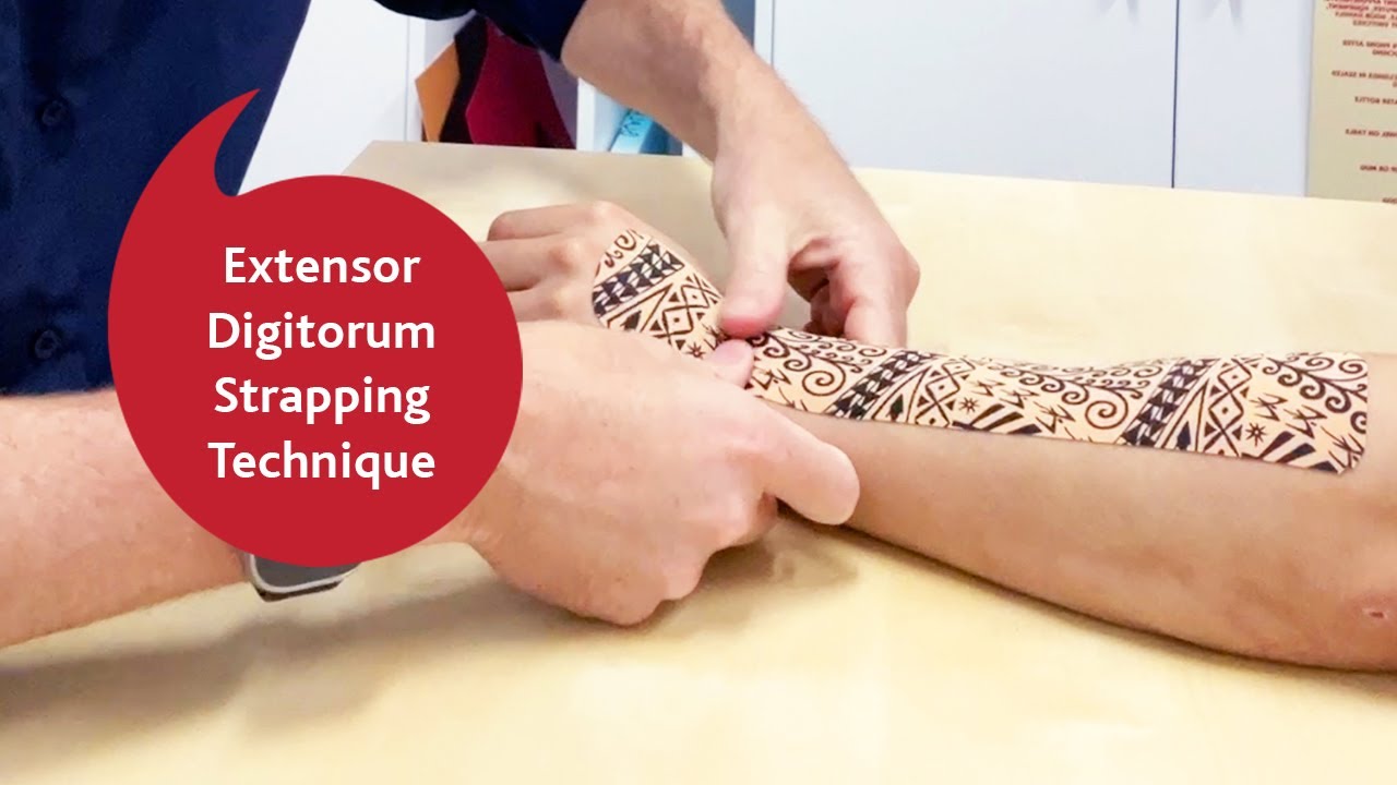 Extensor Digitorum Strapping Technique