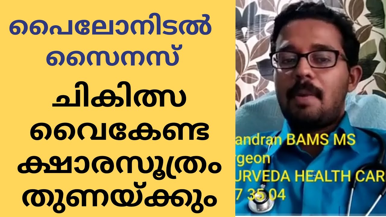 005| Pilonidal sinus ayurveda treatment പൈലോനിഡല്‍ സൈനസ് ആയുര്‍വേദ ചികിത്സ