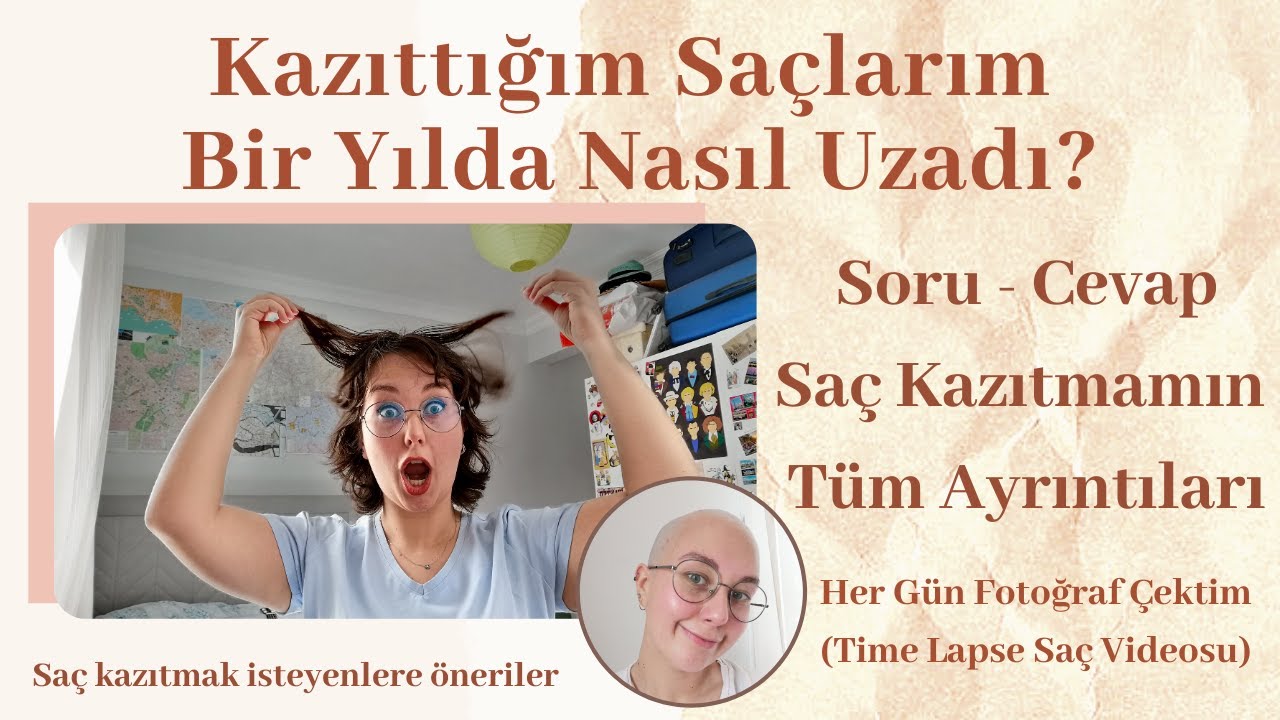 Saçlarımı Kazıtalı Bir Yıl Oldu! Soru - Cevap Ve Öneriler / Time Lapse Saç Uzama Videosu