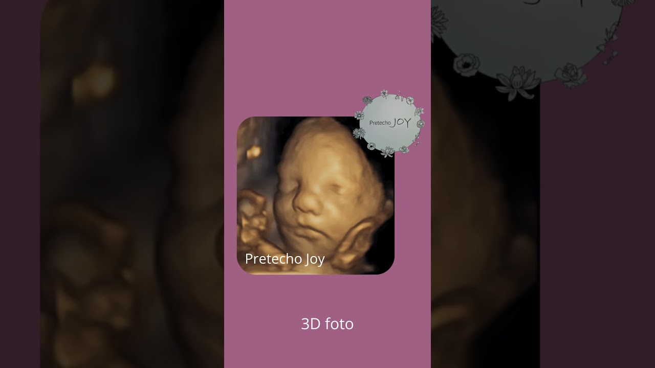 Pretecho Joy Heerlen 2D beeld naar 3D en 4HDlive foto