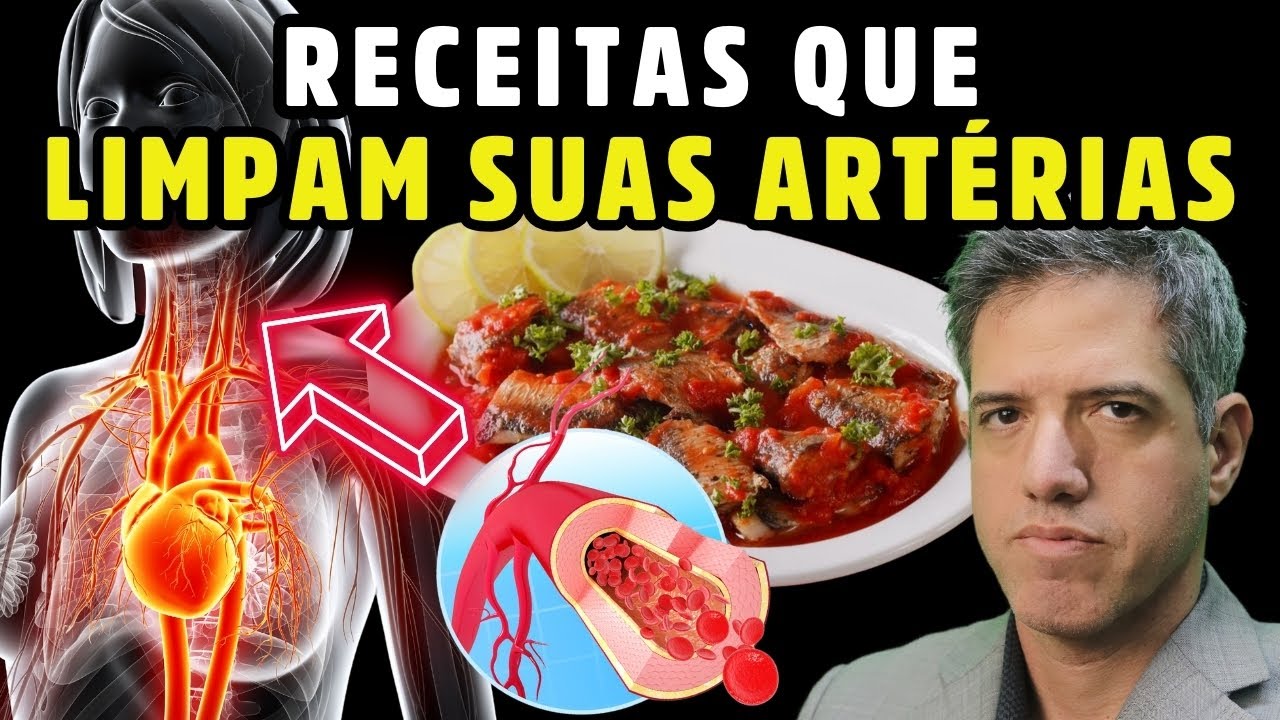 ARTÉRIAS LIMPAS: 4 COMIDAS (RECEITAS) que COMBATEM o ENTUPIMENTO das ARTÉRIAS - Dr Alain Dutra